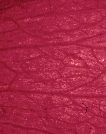 Improves elasticity and tissue strength